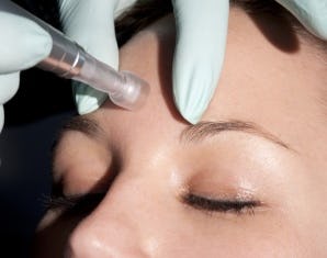 Hautverjüngung durch Mesotherapie in Basel