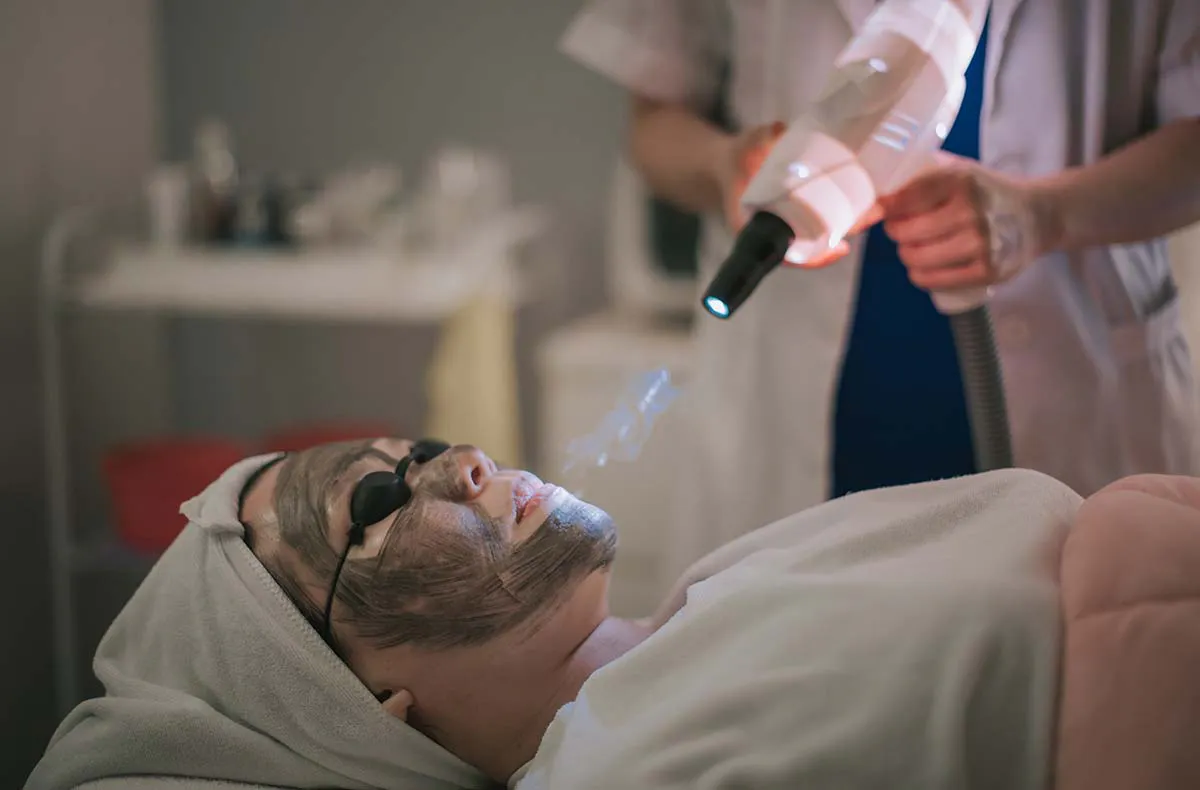 Carbon Peeling München - 6