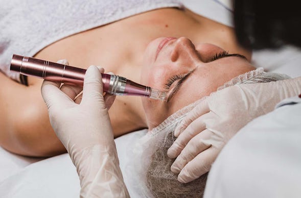 Microneedling Kochel am See